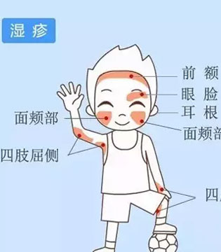 新生儿,新生儿脸上起小红点,新生儿脸上起小红点的原因