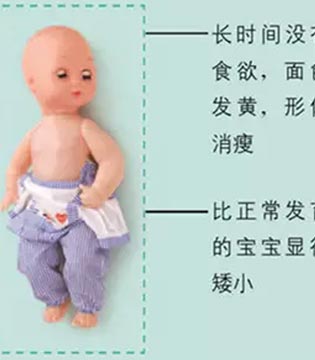 食欲,宝宝的胃口