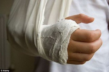 小孩骨折的饮食要点