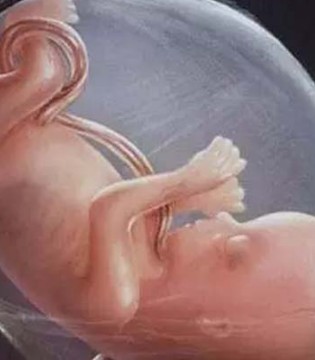 脐带绕颈,剖腹产,顺产