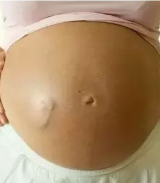 OMG,数胎动方法,胎动