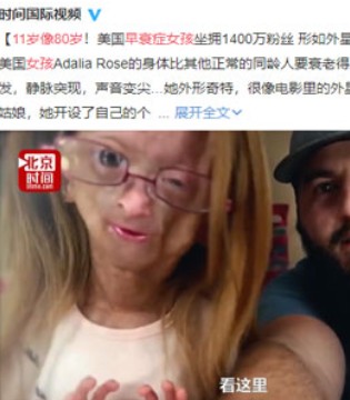 英国,早衰,女孩